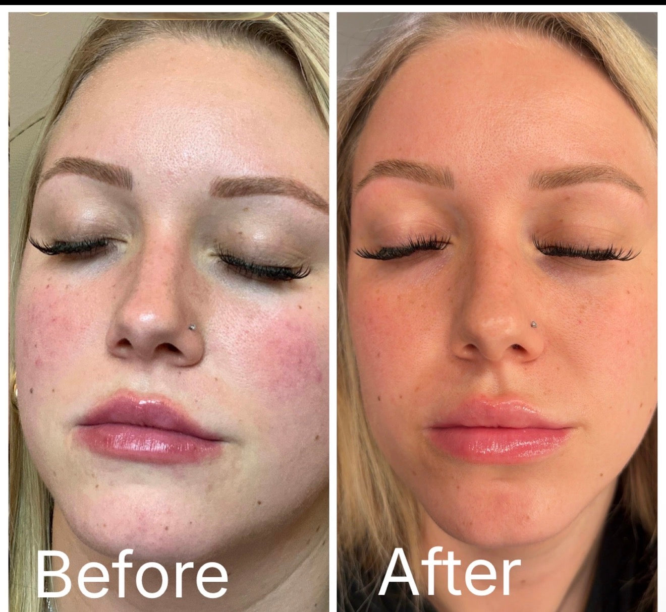 Soothing Foaming Toner