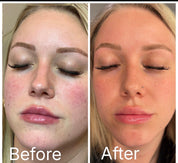 Soothing Foaming Toner