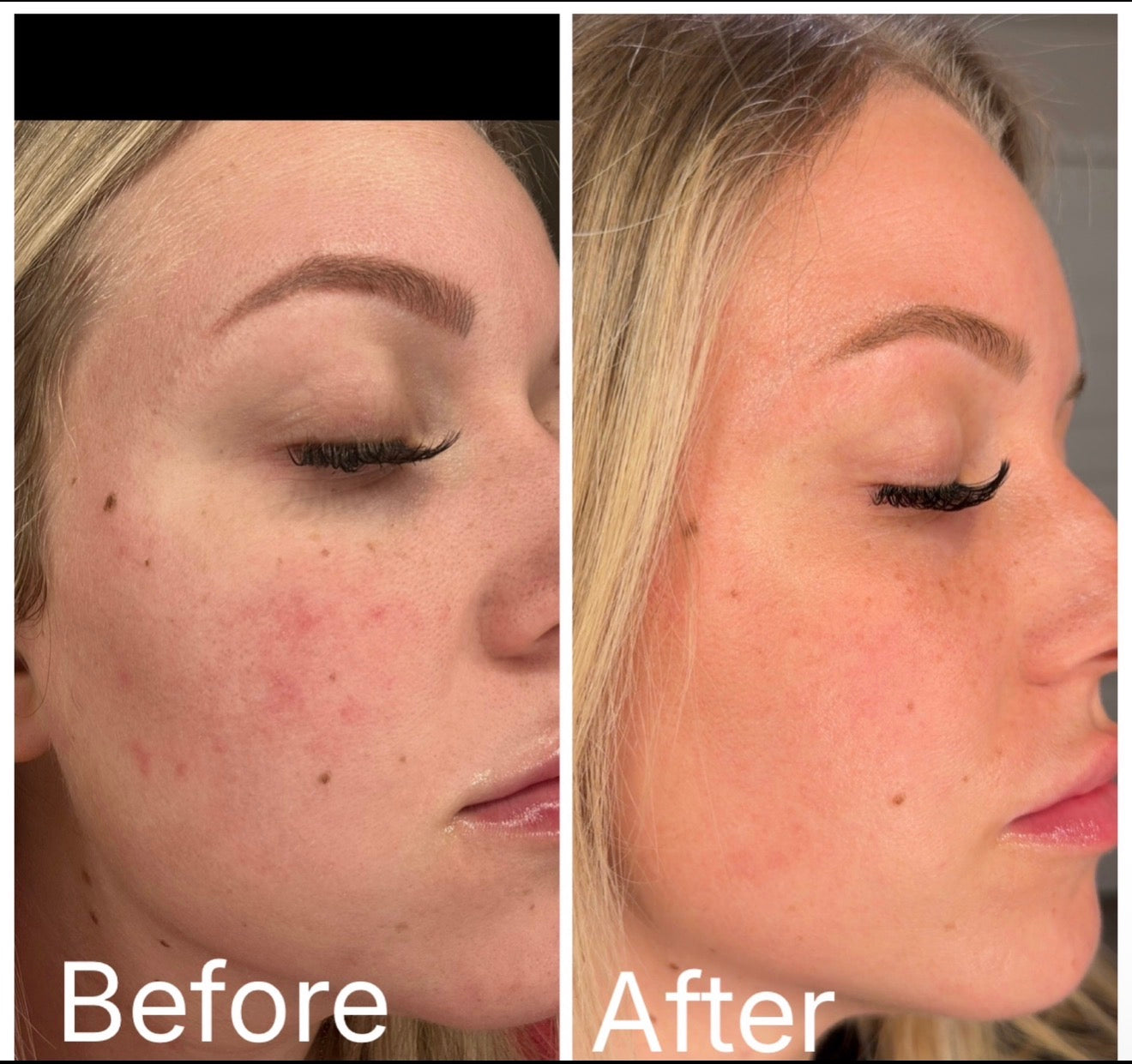 Soothing Foaming Toner