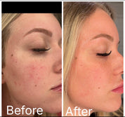 Soothing Foaming Toner